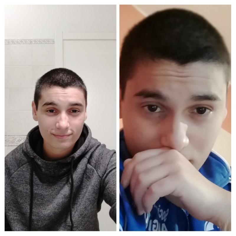 Mi Sono Rasato I Capelli E Sto Male
